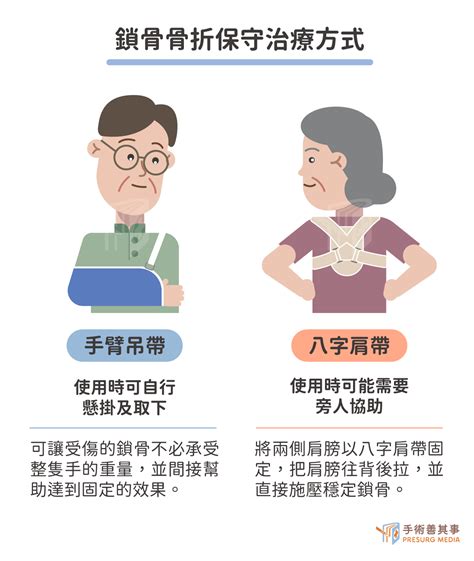 八字肩帶睡覺|鎖骨骨折癒合時間要多久？治療選擇、禁忌動作、注意。